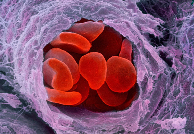 Neviditelní hrdinové v naší krvi. Tipy, jak pečovat o krevní destičky