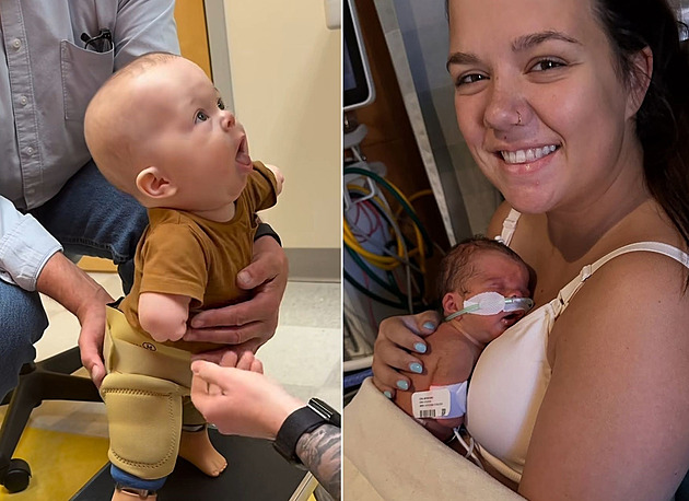 Chlapeček se narodil bez končetin, už nyní je hvězdou internetu