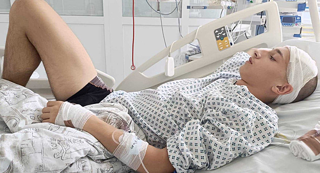 Osmnáctiletý Šimon se pere s nádorem na mozku. Lékařce stačil pohled do očí