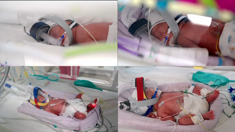 Šance 1 ku 15 milionům. V Austrálii se narodila jednovaječná čtyřčata, rodiče už čtyři děti měli